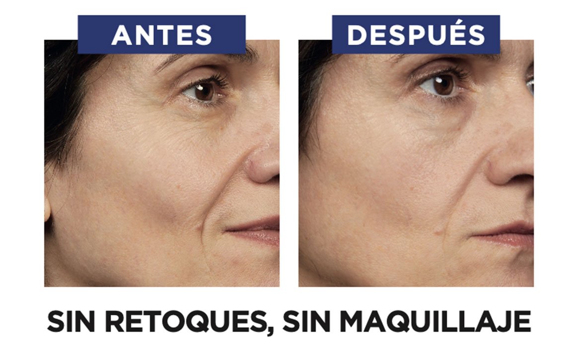A partir de los 30 años no elijas entre retinol o ácido hialurónico y ¡utiliza los dos! Eso sí, el Sérum Noche Retinol Puro Revitalift Laser de L’Oréal Paris implica varias indicaciones de uso que tendrás que tener en cuenta antes de empezarlo a utilizar.
